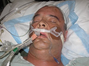 CP20636881