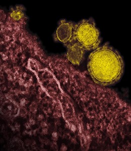 With MERS concerns rising, WHO warns about some camel products, contact | iNFOnews.ca
