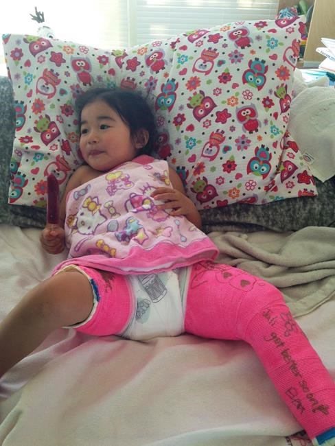 Girl's leg broken during cheese-rolling festival in Whistler, B.C.: lawsuit | iNFOnews.ca