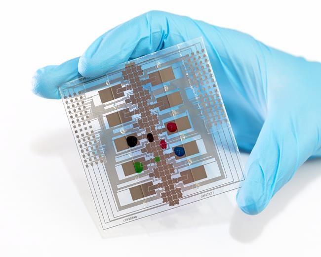 Lab-on-a-chip test could help prevent disease outbreaks in remote regions: Study | iNFOnews.ca Lab-on-a-chip test could help prevent disease outbreaks in remote regions: Study | iNFOnews.ca