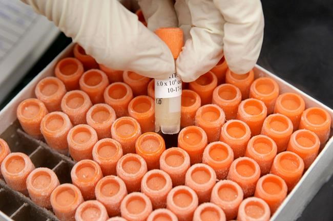 Guidelines on stem cell research put patients first, warn against hyping results | iNFOnews.ca