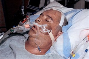 Brain-damaged B.C. man alleges RCMP officer who assaulted him on steroids | iNFOnews.ca CP30149501