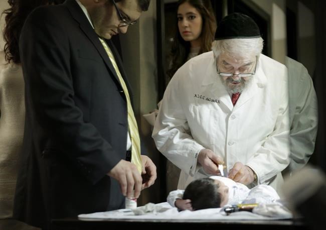 Canada far from willing to ban circumcision say observers | iNFOnews.ca