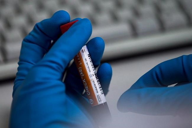 Canada's Beckie Scott says WADA decision "disappointing beyond measure" | iNFOnews.ca