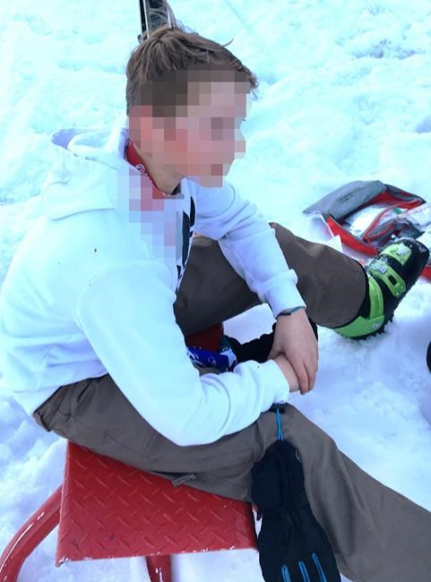 North Vancouver RCMP seek skier whose pole caused brain injury to B.C. teen | iNFOnews.ca North Vancouver RCMP seek skier whose pole caused brain injury to B.C. teen | iNFOnews.ca