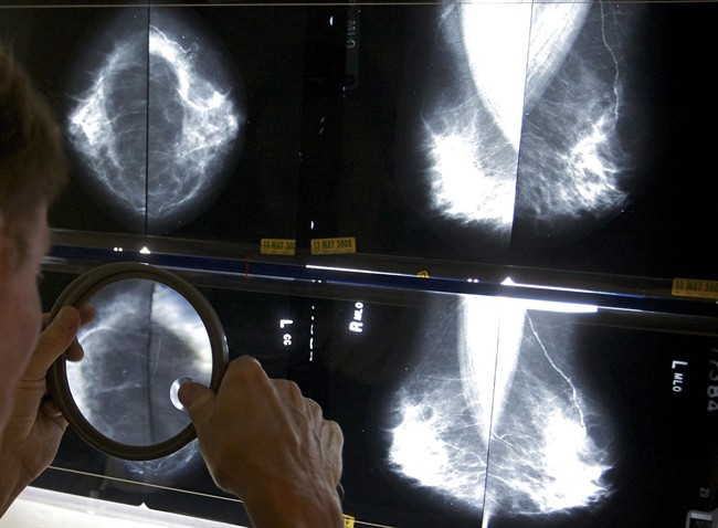 Cancer cases to rise 40% by 2030; aging population fuel increase: report | iNFOnews.ca CP33244359