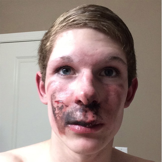 'It lit my kid's face on fire:' Calls for ban on selling e-cigarettes to minors | iNFOnews.ca 'It lit my kid's face on fire:' Calls for ban on selling e-cigarettes to minors | iNFOnews.ca