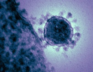 U.S. lab develops animal model for new coronavirus; needed to conduct studies | iNFOnews.ca CP22746019