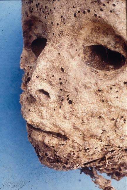 DNA analysis of mummified remains alters notion of how Renaissance-era child died | iNFOnews.ca DNA analysis of mummified remains alters notion of how Renaissance-era child died | iNFOnews.ca