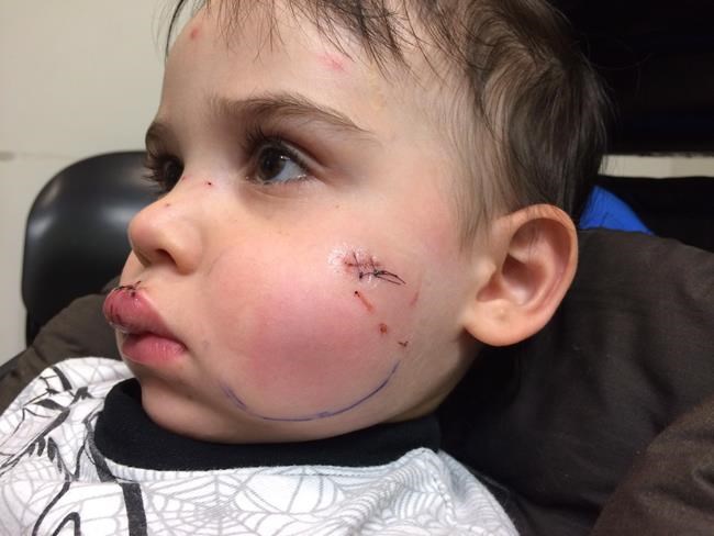 Quebec mom wants laws on dangerous strictly applied after 2-year-old son attacked | iNFOnews.ca