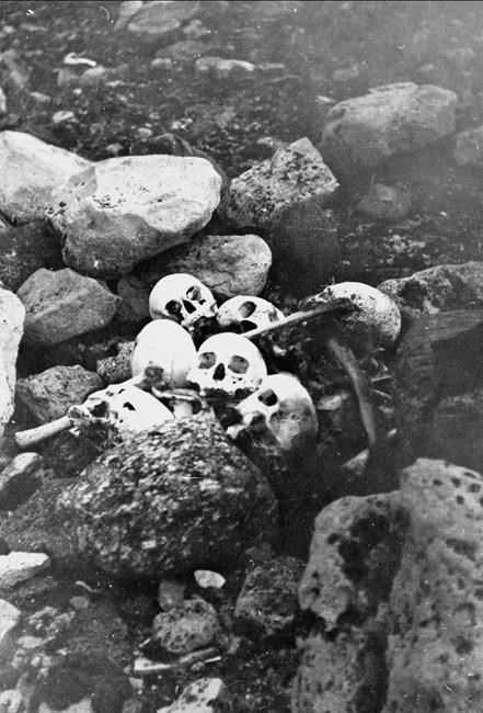 Dentistry prof suggests Addison's disease affected doomed Franklin Expedition | iNFOnews.ca