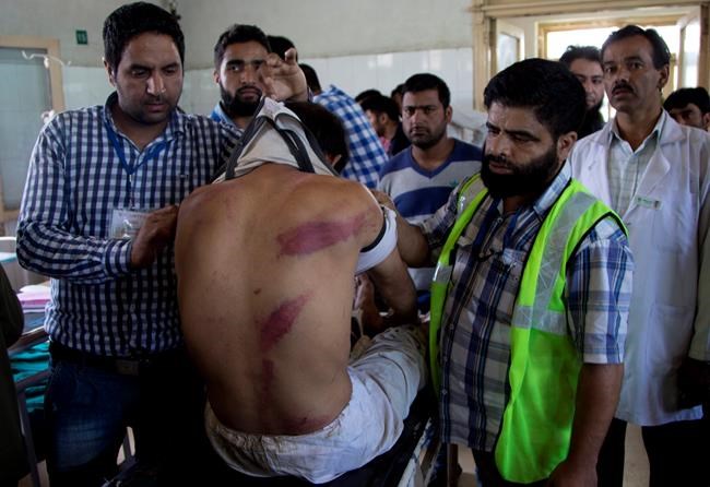 Villagers: Kashmir teacher killed in Indian army's custody | iNFOnews.ca