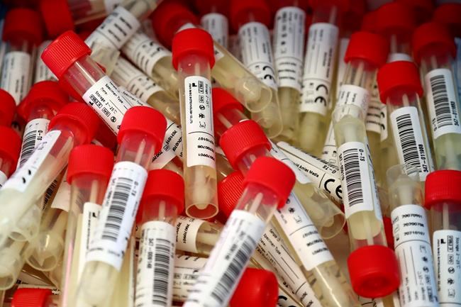 Coronavirus positive? Thousands in Germany left wondering | iNFOnews.ca Coronavirus positive? Thousands in Germany left wondering | iNFOnews.ca