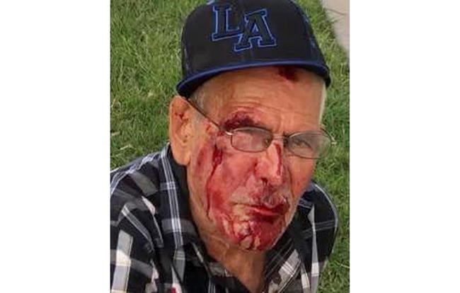 The Latest: Elderly man beaten bloody thanks key witness | iNFOnews.ca The Latest: Elderly man beaten bloody thanks key witness | iNFOnews.ca