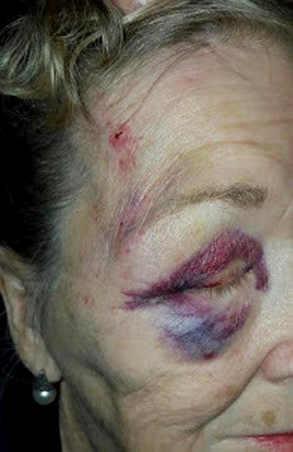 84-year-old woman sues Arizona police citing excessive force | iNFOnews.ca 84-year-old woman sues Arizona police citing excessive force | iNFOnews.ca