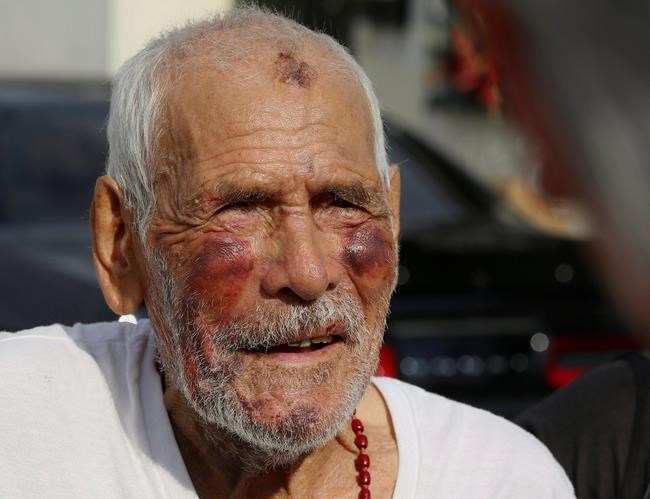 Correction: Elderly Man Beaten story | iNFOnews.ca