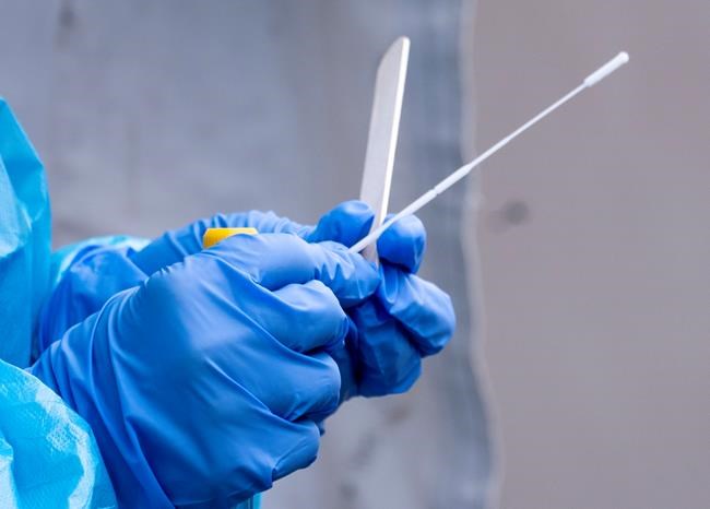 Health Canada reverses course, will review applications for COVID-19 home tests | iNFOnews.ca