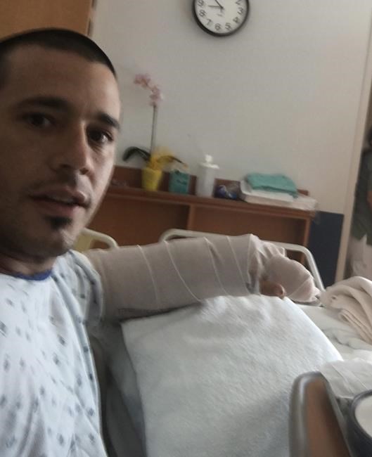 Surfer bitten by shark at beach; says 'came out of nowhere' | iNFOnews.ca