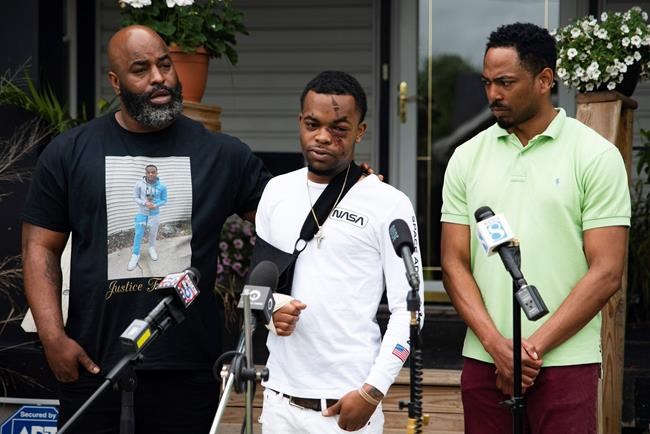 2 charged in Iowa assault that NAACP says was racist | iNFOnews.ca 2 charged in Iowa assault that NAACP says was racist | iNFOnews.ca