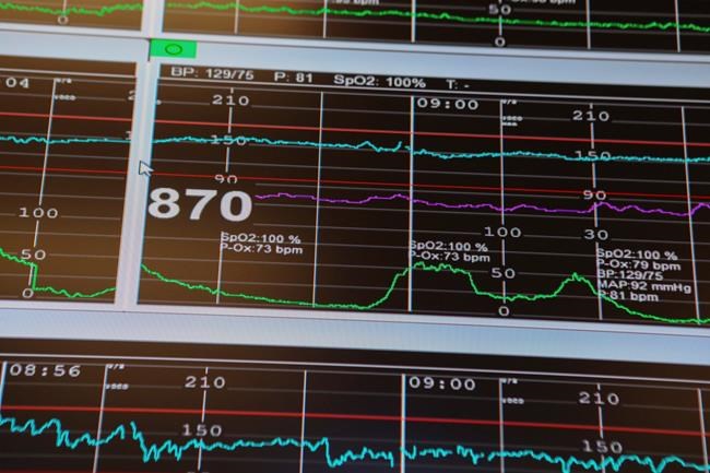 Helping nature: Inducing labour avoids cesarean for some moms | iNFOnews.ca