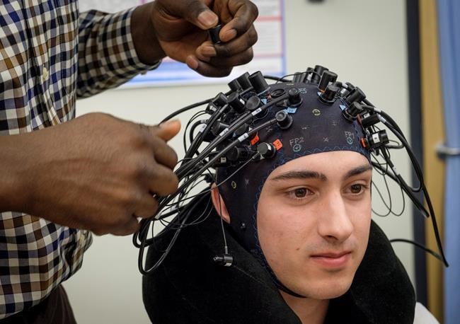 Portable imaging system to help identify concussions using brain activity | iNFOnews.ca CP421070325