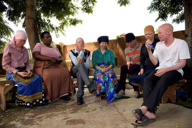 People with albinism issued with protective alarms in Malawi | iNFOnews.ca People with albinism issued with protective alarms in Malawi | iNFOnews.ca