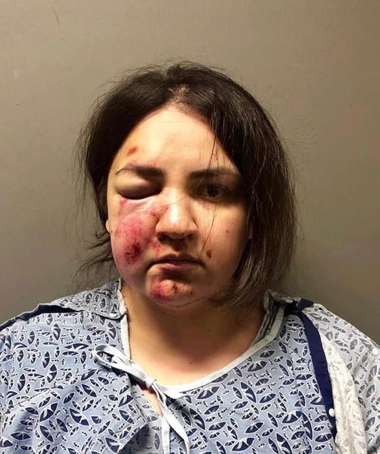 Mother charged in death of baby, tossing son from 2nd floor | iNFOnews.ca Mother charged in death of baby, tossing son from 2nd floor | iNFOnews.ca