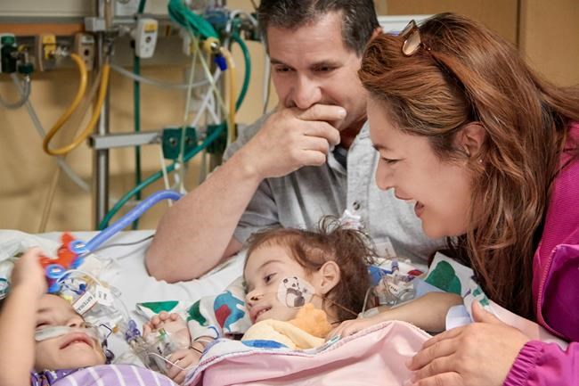 Separated conjoined twins meet for first time since surgery | iNFOnews.ca