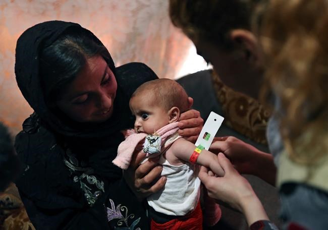 UN children agency seeks $3.3 billion in support in 2017 | iNFOnews.ca