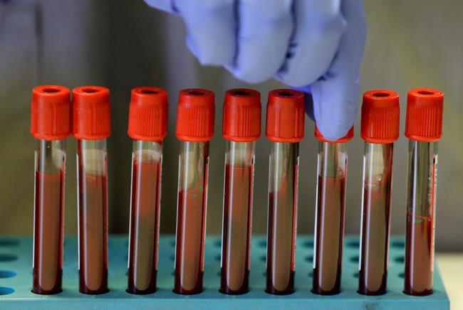 UK scientists to immunize hundreds with coronavirus vaccine | iNFOnews.ca