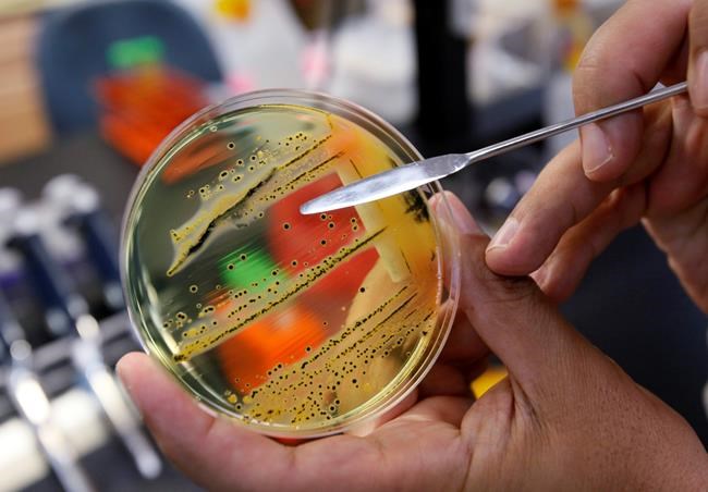 The dirty dozen: UN issues list of 12 most worrying bacteria | iNFOnews.ca