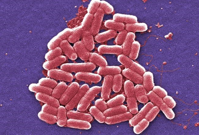Study: Superbug infections found in Chinese hospitals | iNFOnews.ca