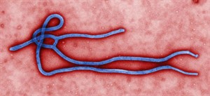 How does Ebola virus spread and can it be stopped? | iNFOnews.ca CP29403143