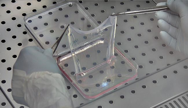 Boy with rare disease gets brand new skin with gene therapy | iNFOnews.ca