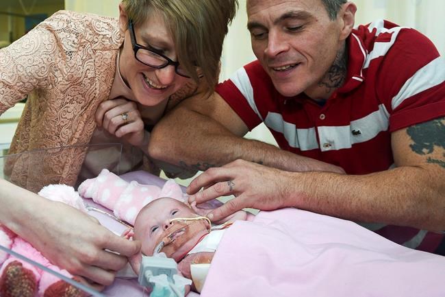 Baby's heart placed back inside her chest in rare surgeries | iNFOnews.ca CP889259486