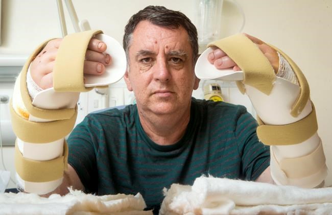 Man doing well after UK's first double hand transplant | iNFOnews.ca Man doing well after UK's first double hand transplant | iNFOnews.ca