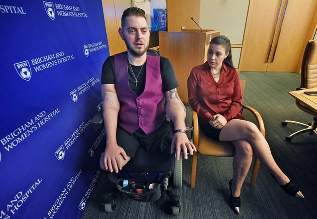 Arm transplant recipient says he can now hold fiancee's hand | iNFOnews.ca CP402654889