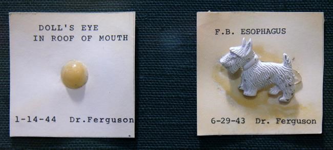 Yuck! The weird things kids swallow or stuff go on display | iNFOnews.ca Yuck! The weird things kids swallow or stuff go on display | iNFOnews.ca