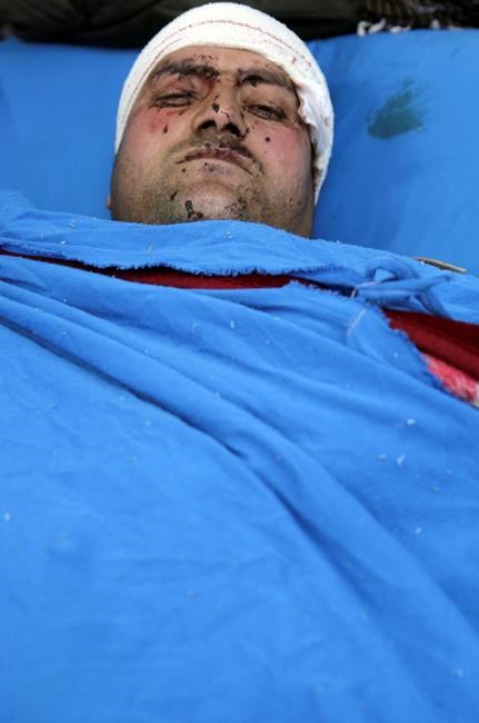 Taliban suicide bomber kills 4, wounds over 100 in Kabul | iNFOnews.ca