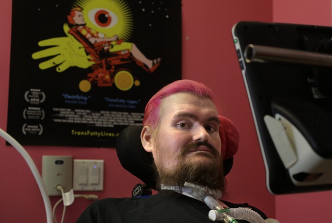 Using just his eyes, filmmaker captures his fight with ALS | iNFOnews.ca CP36935837