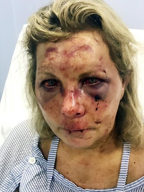 Dominican police investigating attack on US woman at resort | iNFOnews.ca