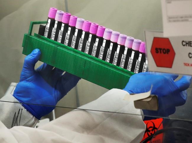 Pence to visit Mayo Clinic to learn about testing 'moonshot' | iNFOnews.ca