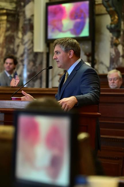 Mississippi Senate OKs ban on abortion after fetal heartbeat | iNFOnews.ca