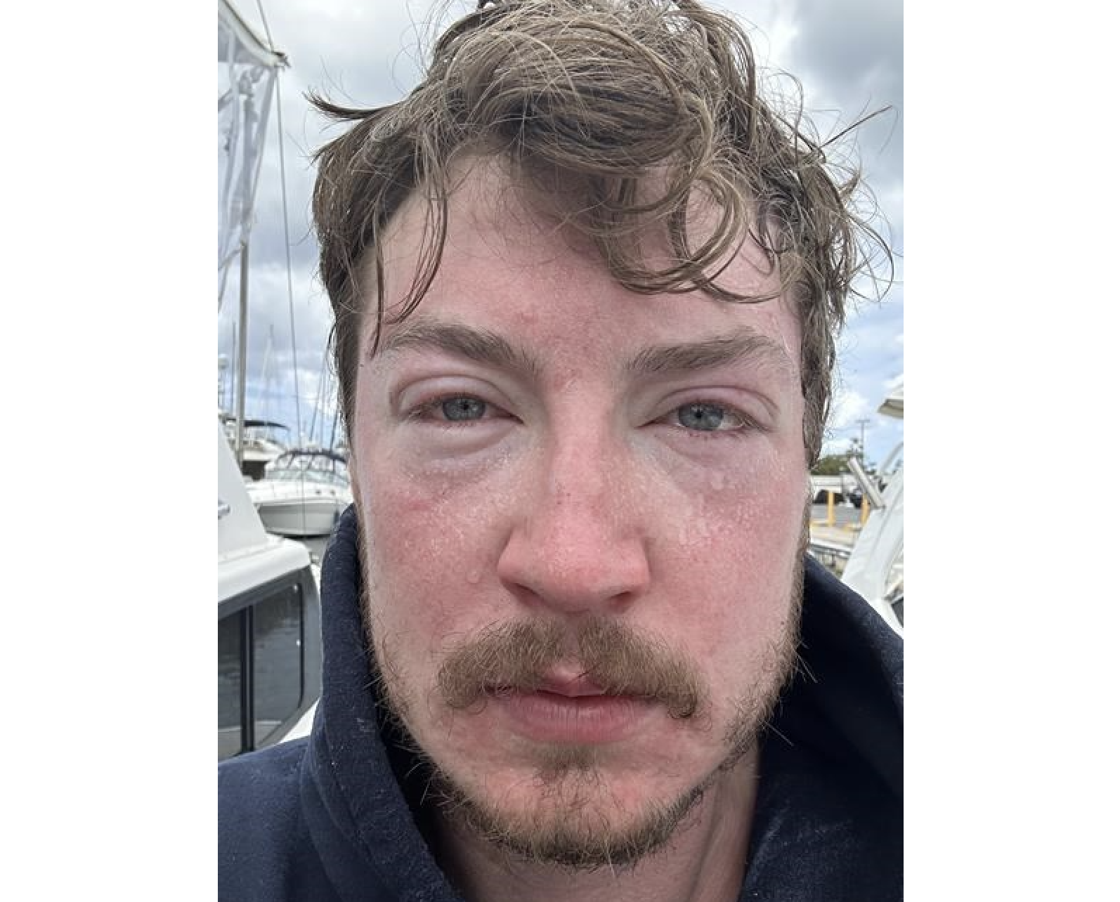 'Like a hot iron': Kelowna man's ultra-marathon Hawaiian swim is scuttled by jellyfish | iNFOnews.ca