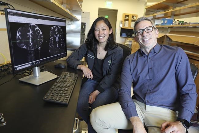 A peek inside human brain shows a way it cleans out waste | iNFOnews.ca