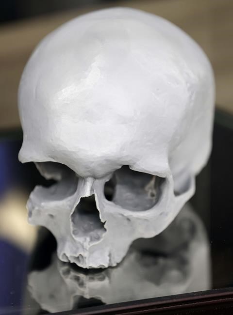 DNA tests identify 19th-century teenager's skull found in Illinois home's wall | iNFOnews.ca DNA tests identify 19th-century teenager's skull found in Illinois home's wall | iNFOnews.ca