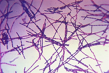 CDC says no signs of anthrax illness weeks after lab safety incident; 33 can stop antibiotics | iNFOnews.ca CDC says no signs of anthrax illness weeks after lab safety incident; 33 can stop antibiotics | iNFOnews.ca