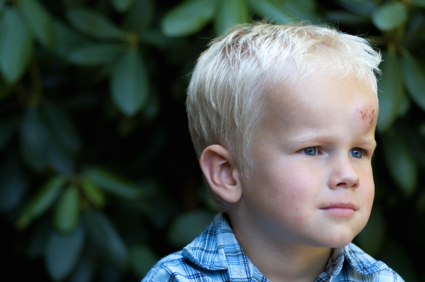 Website helps parents, coaches recognize concussion signs in kids, what to do | iNFOnews.ca Website helps parents, coaches recognize concussion signs in kids, what to do | iNFOnews.ca