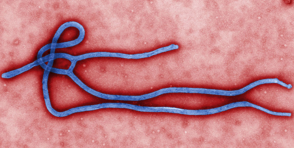 Canada prepping for potential Ebola cases but still sees risk as low: Ambrose | iNFOnews.ca Canada prepping for potential Ebola cases but still sees risk as low: Ambrose | iNFOnews.ca