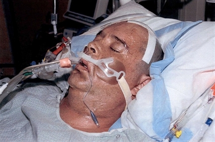 Brain-damaged B.C. man alleges RCMP officer who assaulted him on steroids | iNFOnews.ca